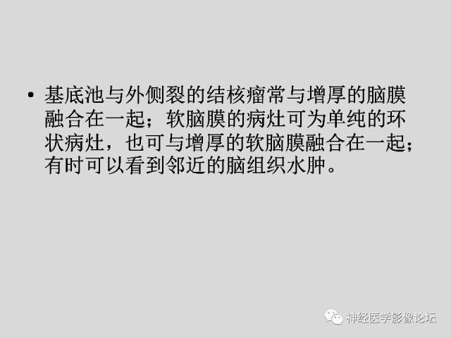 【PPT】颅内结核