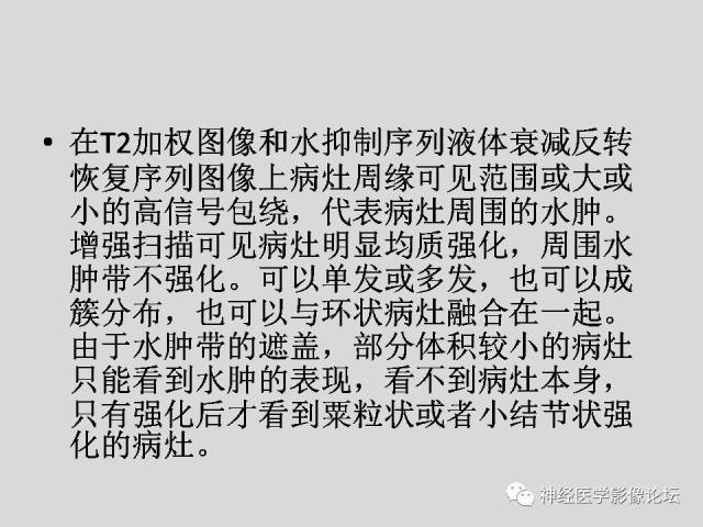 【PPT】颅内结核