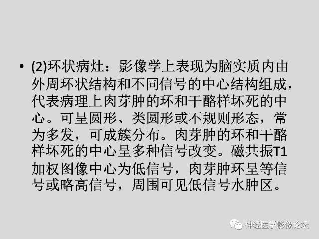【PPT】颅内结核