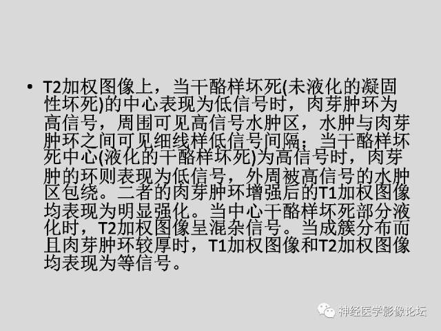 【PPT】颅内结核
