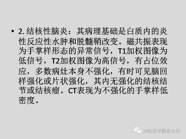 【PPT】颅内结核
