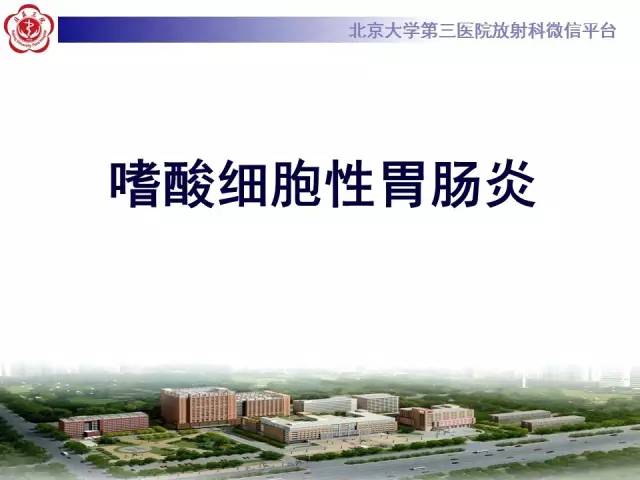 【病例】嗜酸细胞性胃肠炎1例CT