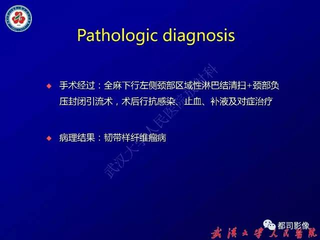 【病例】颈部韧带样纤维瘤病1例影像诊断