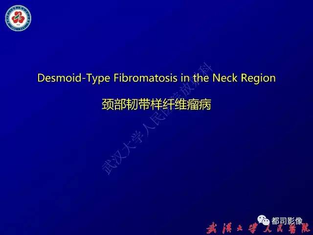 【病例】颈部韧带样纤维瘤病1例影像诊断