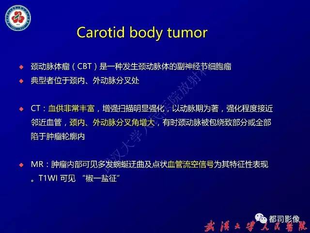 【病例】颈部韧带样纤维瘤病1例影像诊断