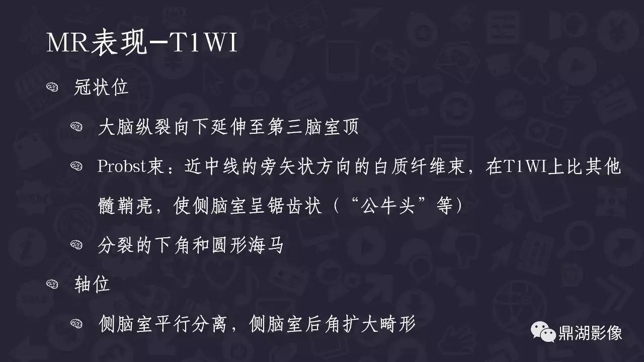 【PPT】胼胝体发育不全 【PPT】胼胝体发育不全