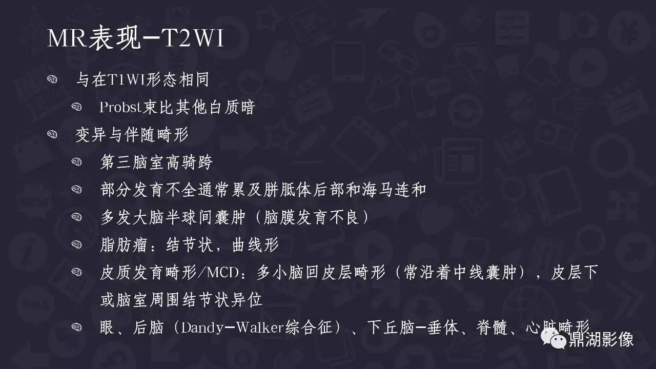 【PPT】胼胝体发育不全 【PPT】胼胝体发育不全