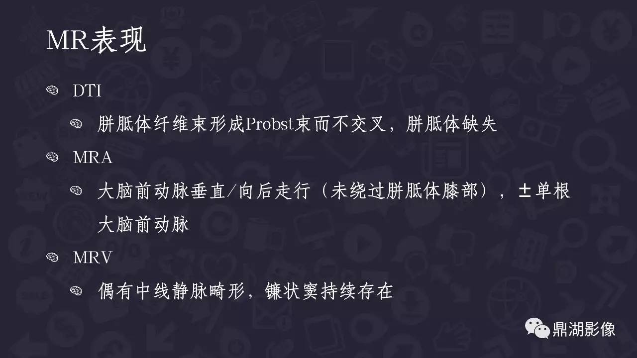 【PPT】胼胝体发育不全 【PPT】胼胝体发育不全