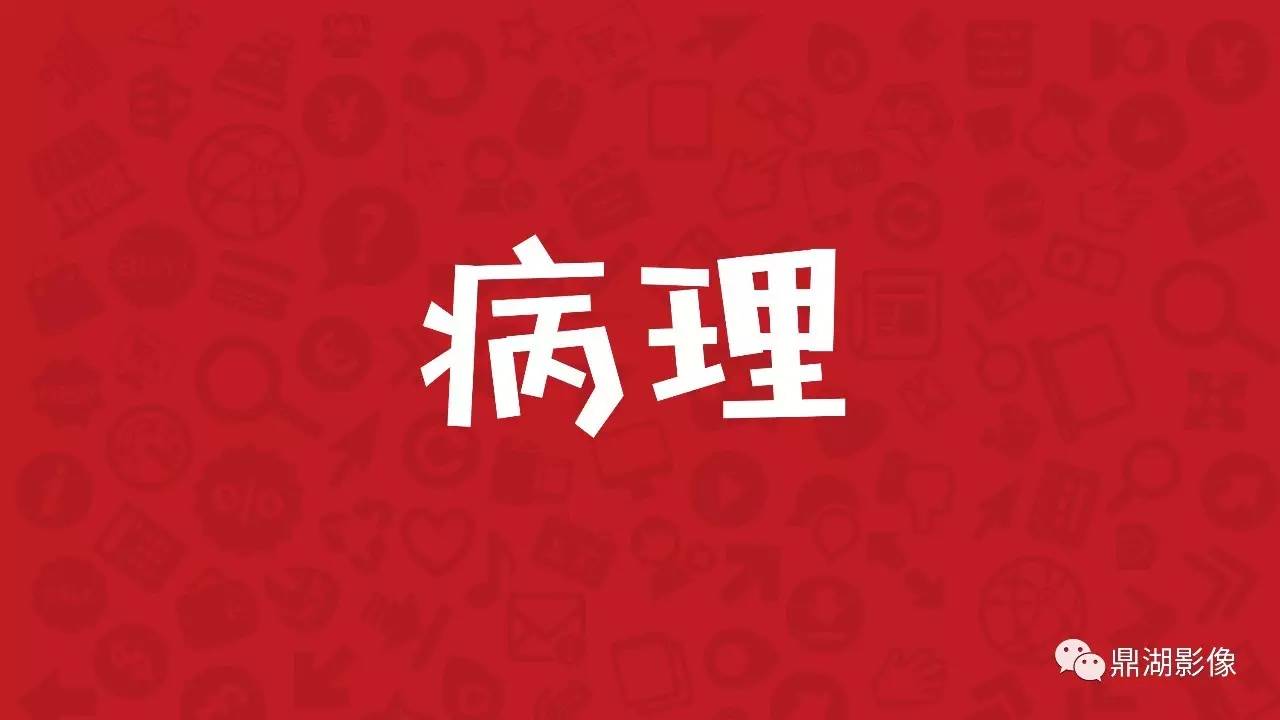【PPT】胼胝体发育不全 【PPT】胼胝体发育不全