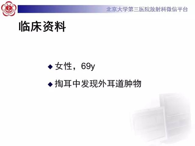 【病例】鼓室副神经节瘤2例CT及MR