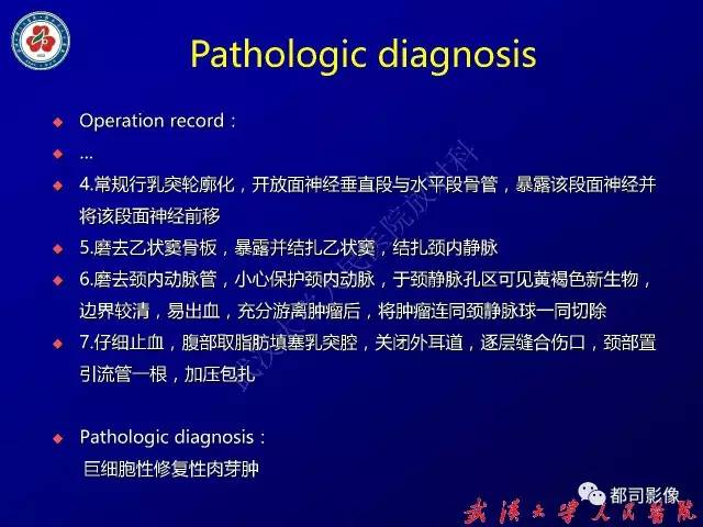 【病例】颞骨巨细胞修复性肉芽肿1例CT及MR影像诊断