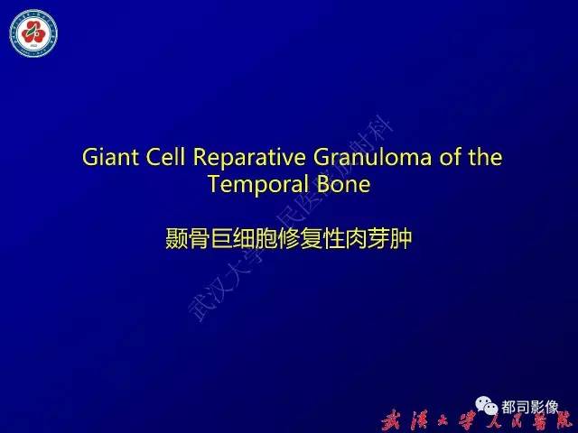 【病例】颞骨巨细胞修复性肉芽肿1例CT及MR影像诊断