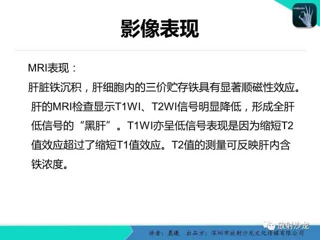 【病例】铁过载1例CT