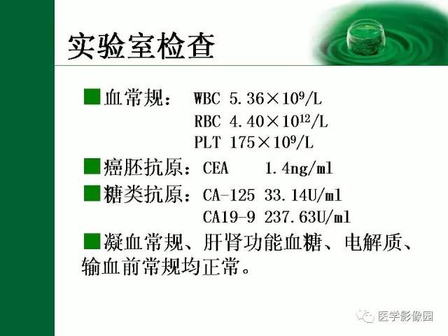 【病例】阑尾粘液腺癌1例CT 【病例】阑尾粘液腺癌1例CT