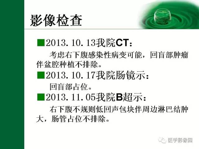 【病例】阑尾粘液腺癌1例CT 【病例】阑尾粘液腺癌1例CT