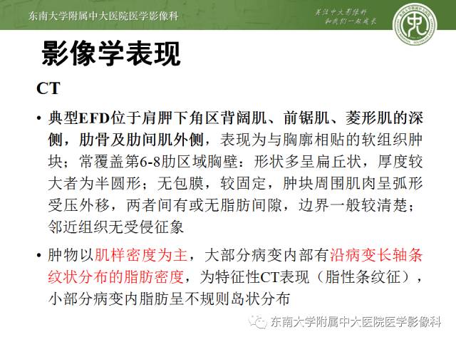 【病例】左侧胸壁弹力纤维瘤1例CT及MR影像诊断