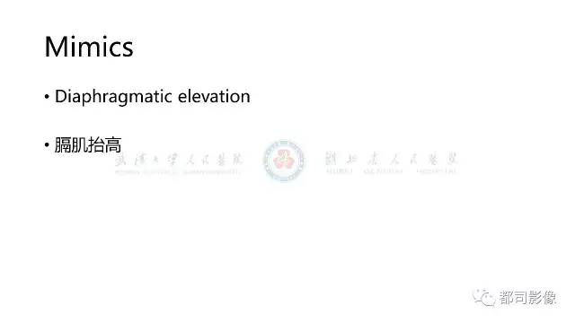 【PPT】膈肌功能障碍的影像学评价 【PPT】膈肌功能障碍的影像学评价
