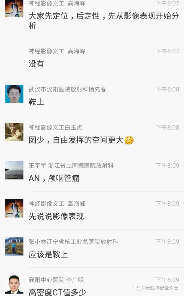 【病例】鞍上、三脑室区脊索样胶质瘤一例CT及MR影像讨论