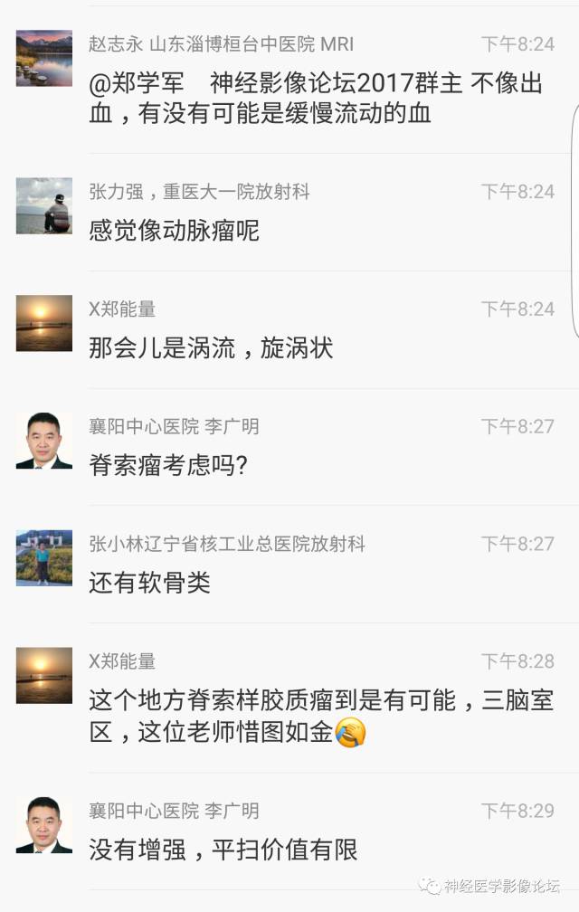 【病例】鞍上、三脑室区脊索样胶质瘤一例CT及MR影像讨论