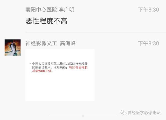 【病例】鞍上、三脑室区脊索样胶质瘤一例CT及MR影像讨论