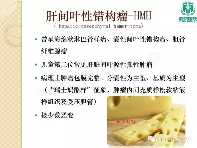 【PPT】儿童肝脏肿瘤