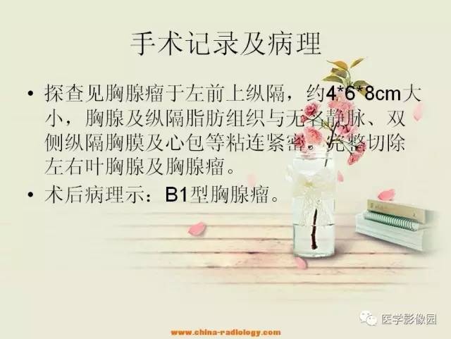 【病例】