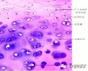 MRI对膝关节软骨损伤的诊断 MRI对膝关节软骨损伤的诊断