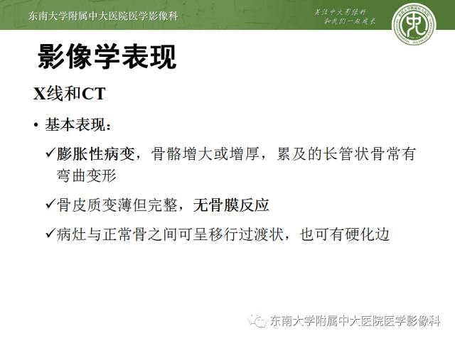 【病例】左股骨骨纤维异常增殖症1例X线CT影像诊断