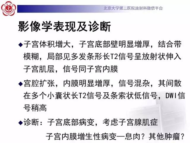 【病例】子宫内膜息肉2例MR影像诊断