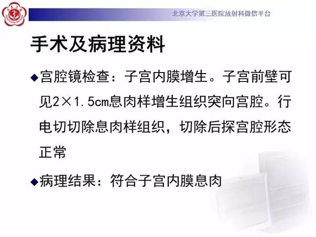 【病例】子宫内膜息肉2例MR影像诊断