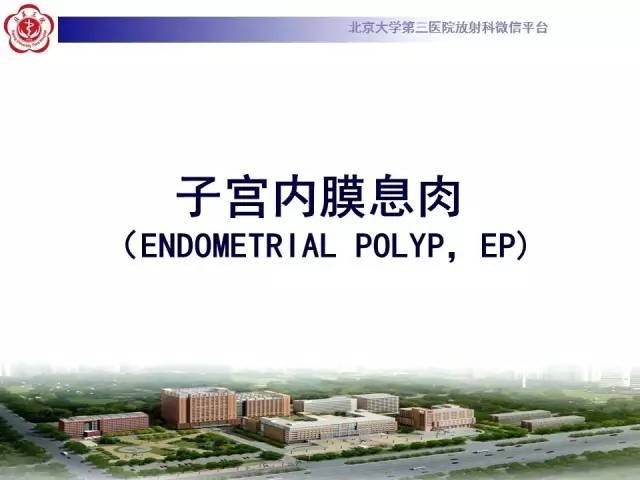 【病例】子宫内膜息肉2例MR影像诊断