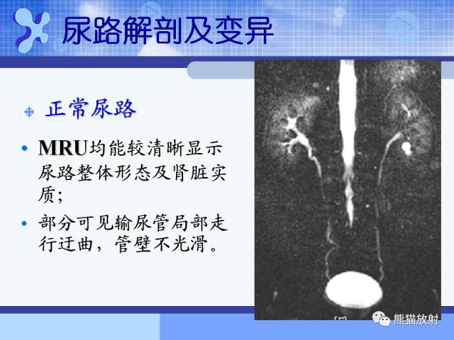 【PPT】MRU技术及临床应用 【PPT】MRU技术及临床应用