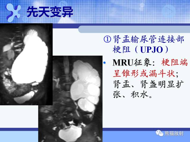 【PPT】MRU技术及临床应用 【PPT】MRU技术及临床应用