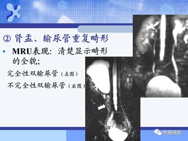 【PPT】MRU技术及临床应用 【PPT】MRU技术及临床应用