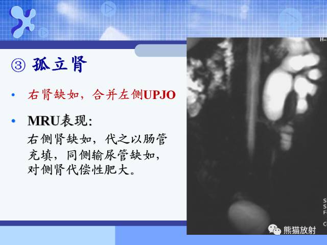 【PPT】MRU技术及临床应用 【PPT】MRU技术及临床应用