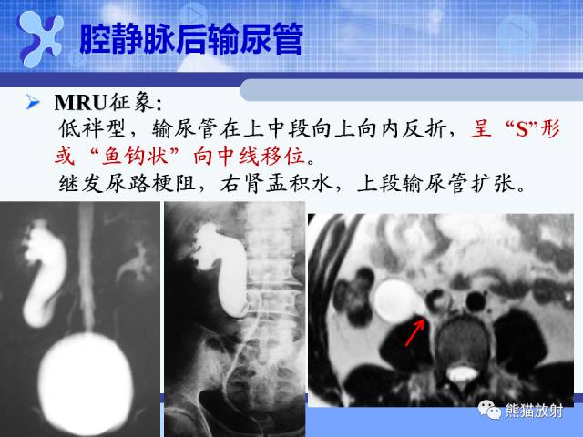 【PPT】MRU技术及临床应用 【PPT】MRU技术及临床应用