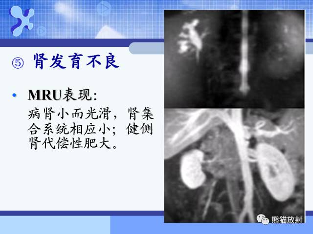 【PPT】MRU技术及临床应用 【PPT】MRU技术及临床应用