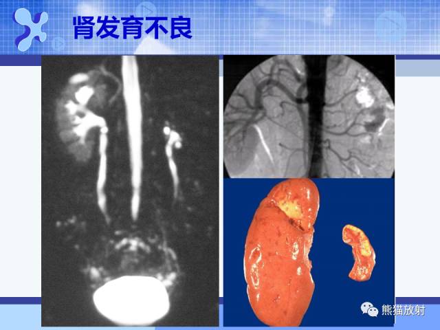 【PPT】MRU技术及临床应用 【PPT】MRU技术及临床应用