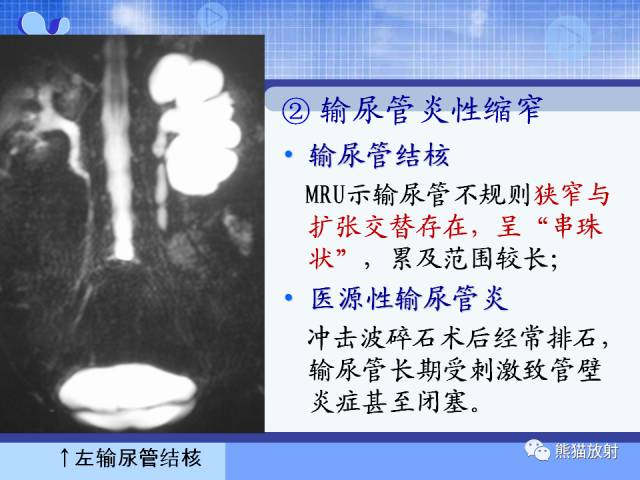 【PPT】MRU技术及临床应用 【PPT】MRU技术及临床应用