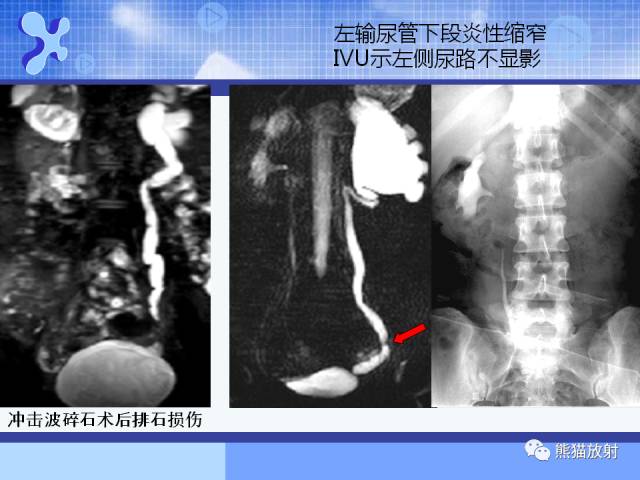 【PPT】MRU技术及临床应用 【PPT】MRU技术及临床应用