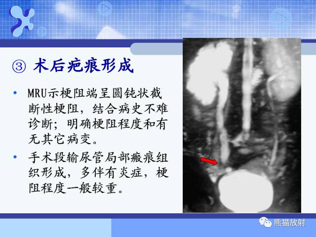 【PPT】MRU技术及临床应用 【PPT】MRU技术及临床应用