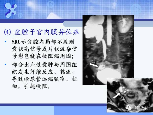 【PPT】MRU技术及临床应用 【PPT】MRU技术及临床应用
