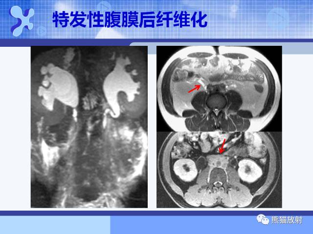 【PPT】MRU技术及临床应用 【PPT】MRU技术及临床应用