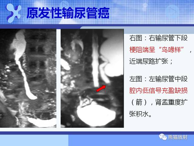 【PPT】MRU技术及临床应用 【PPT】MRU技术及临床应用