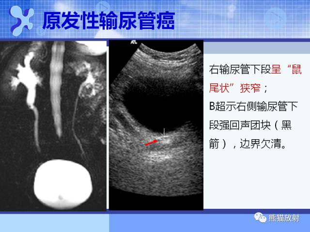 【PPT】MRU技术及临床应用 【PPT】MRU技术及临床应用