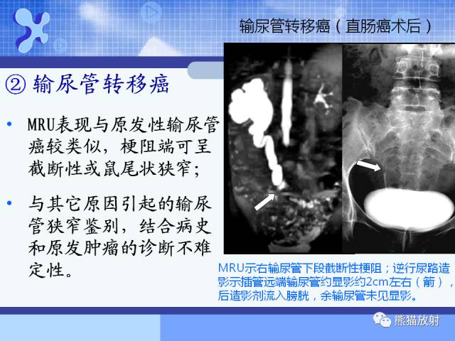 【PPT】MRU技术及临床应用 【PPT】MRU技术及临床应用