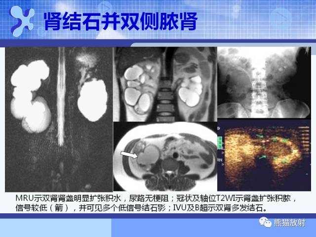 【PPT】MRU技术及临床应用 【PPT】MRU技术及临床应用