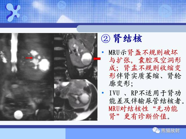 【PPT】MRU技术及临床应用 【PPT】MRU技术及临床应用