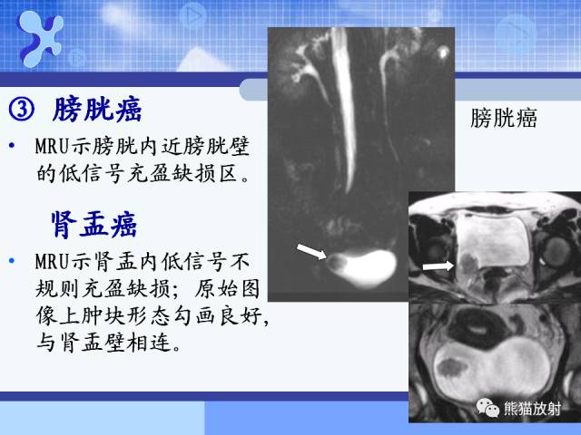 【PPT】MRU技术及临床应用 【PPT】MRU技术及临床应用