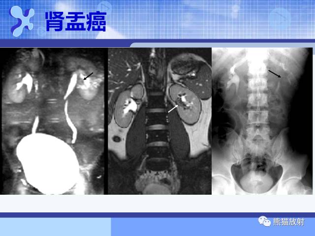 【PPT】MRU技术及临床应用 【PPT】MRU技术及临床应用